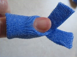 The Mallet Finger Orthosis 5